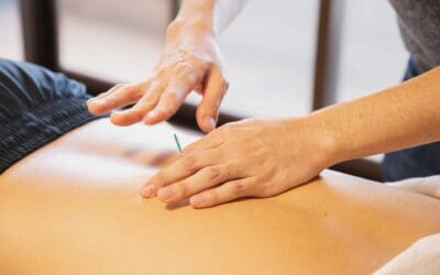 How dry needling supports pelvic floor therapy: 5 key insights